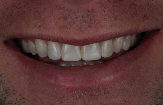 After