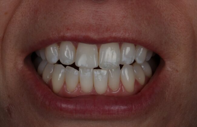 After