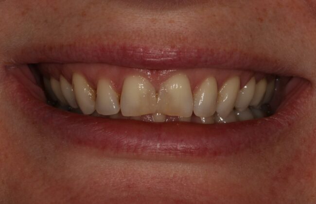 Before