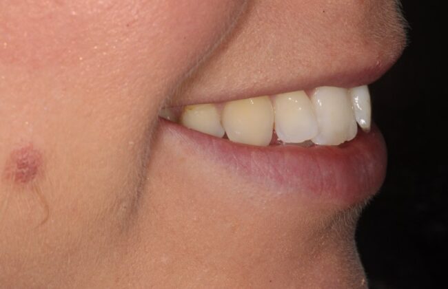 Before