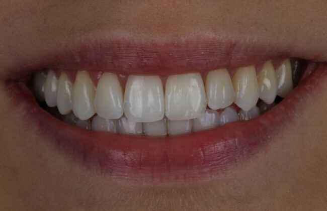 After