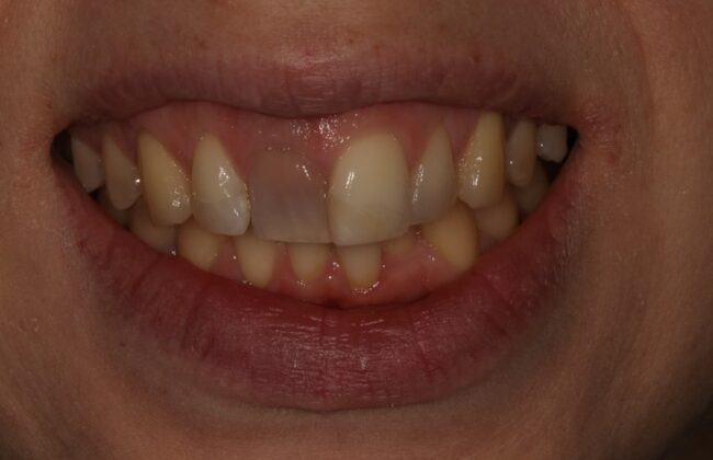 Before