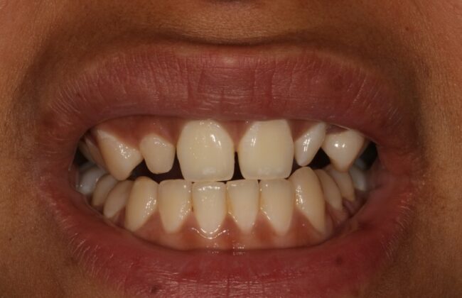 Before