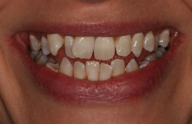 Before