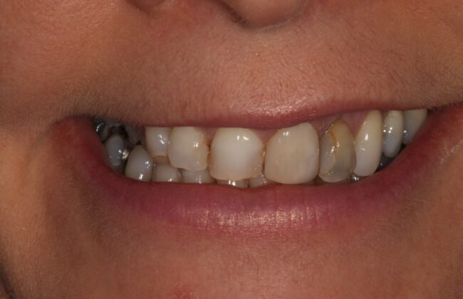 Before