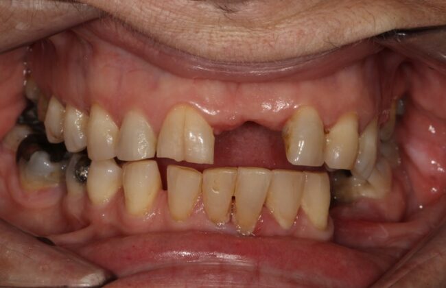 Before