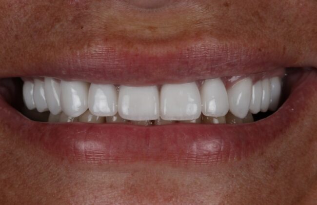 After