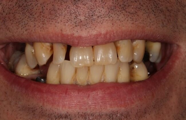 Before