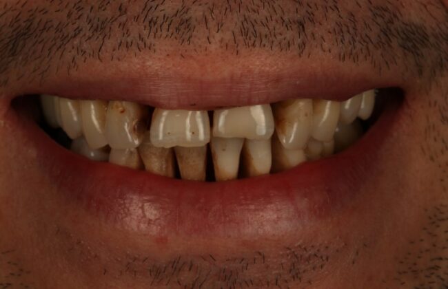 Before
