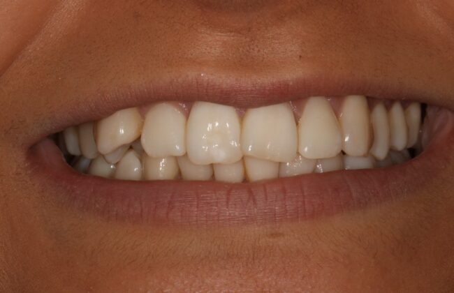 Before