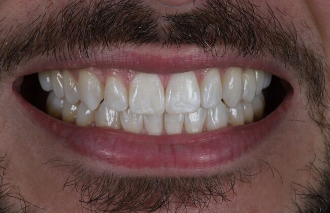 After