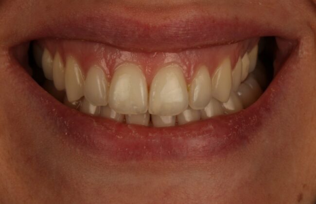 After