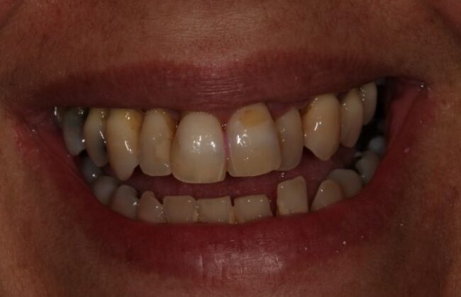 Before