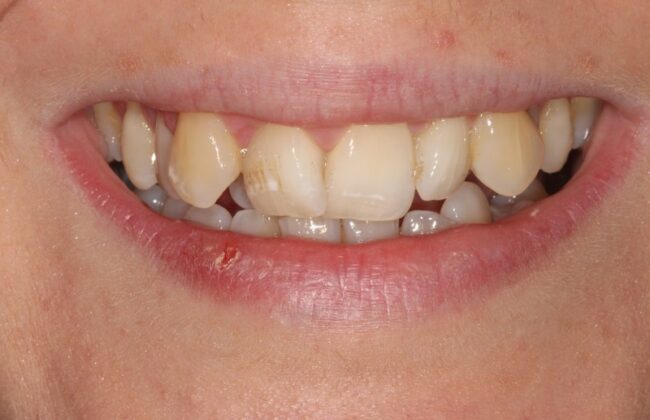 Before