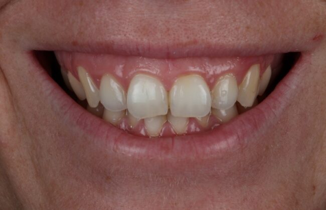 Before