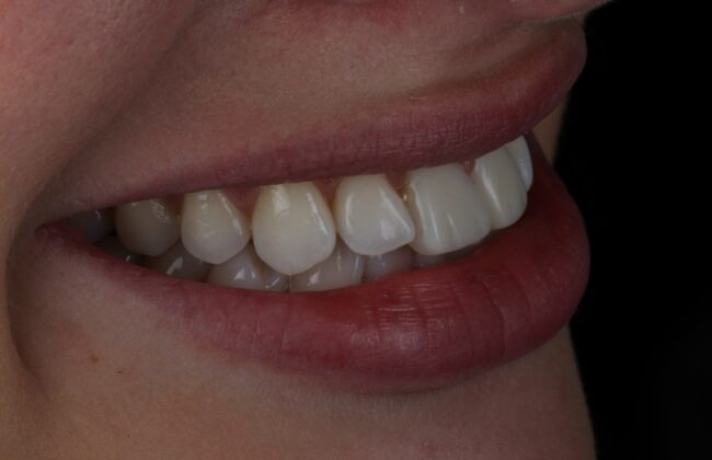 After