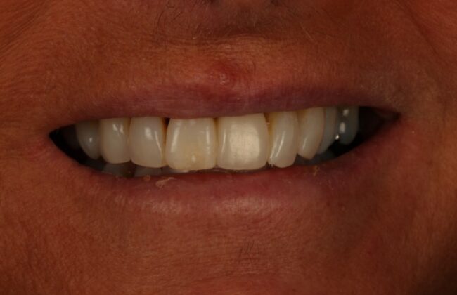 After