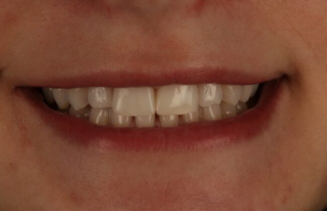 After