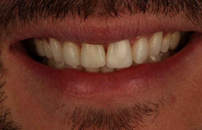 After