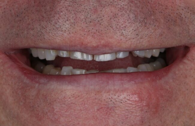 Before