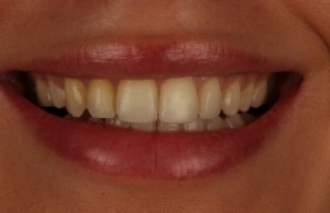 After