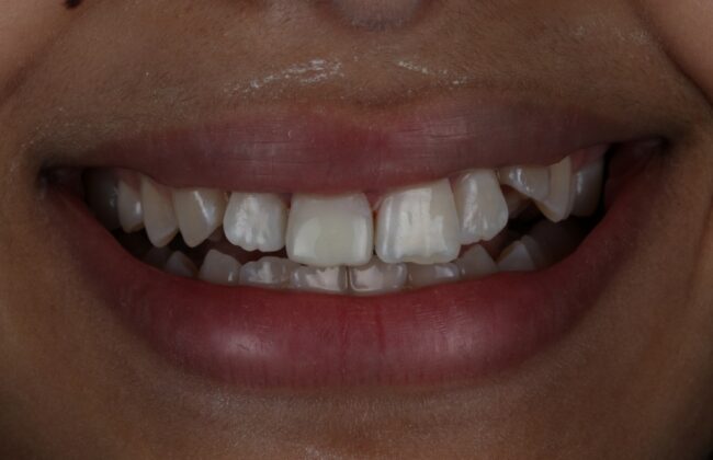 After