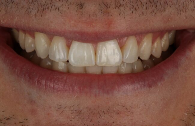 After