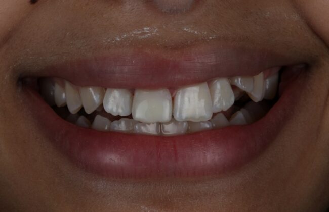 After