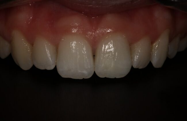 After