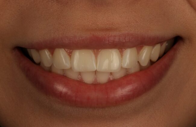 After
