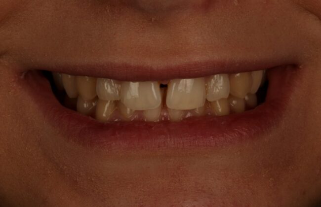 Before