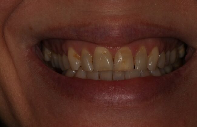 Before