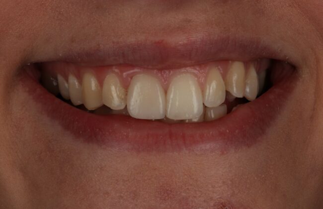After
