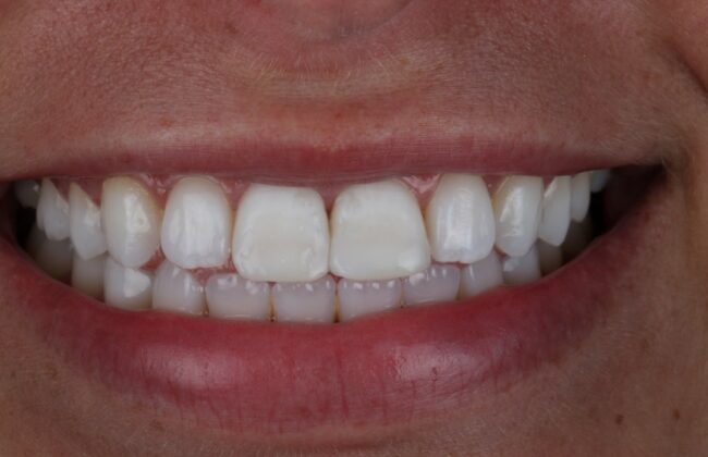 After