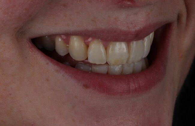 After
