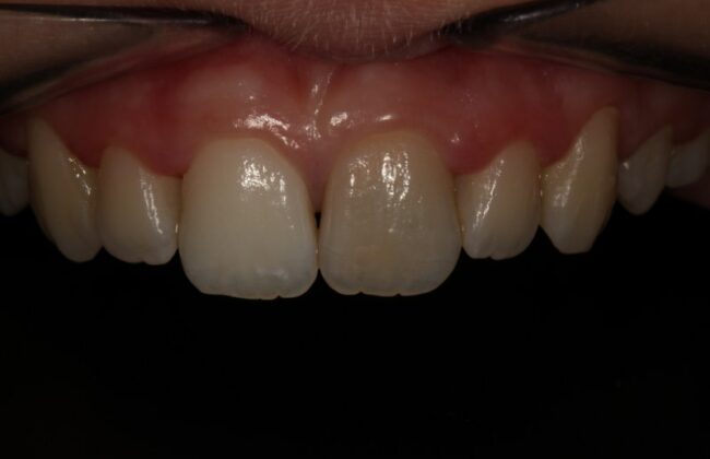 Before