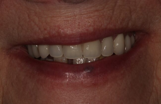 After