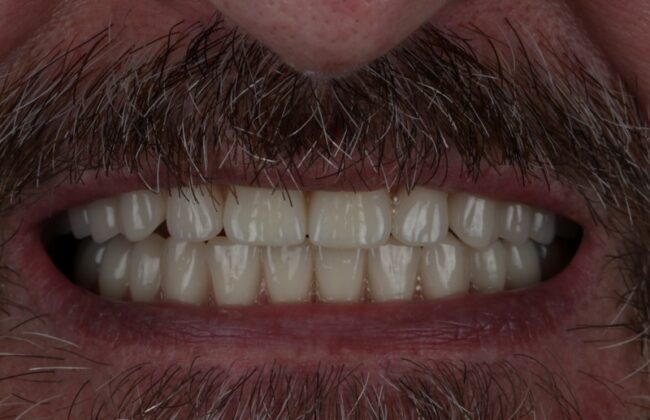 After