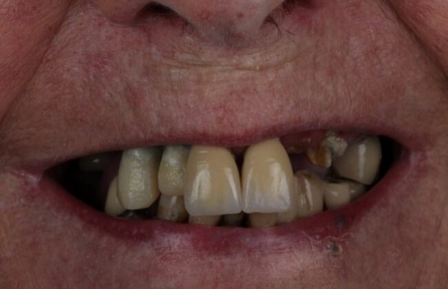 Before