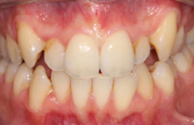 Before