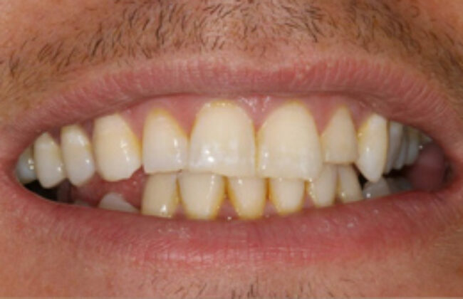 Before