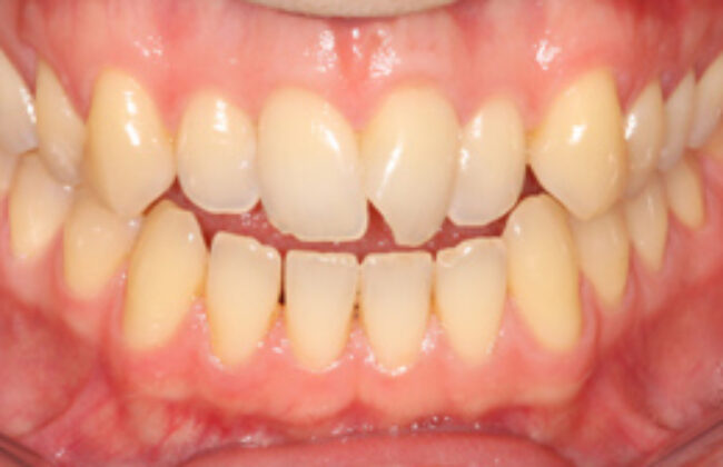 Before