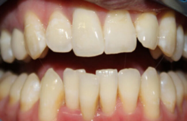 Before