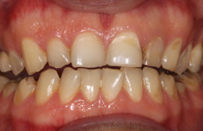 Before