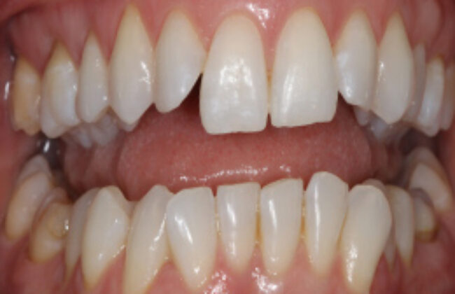 Before