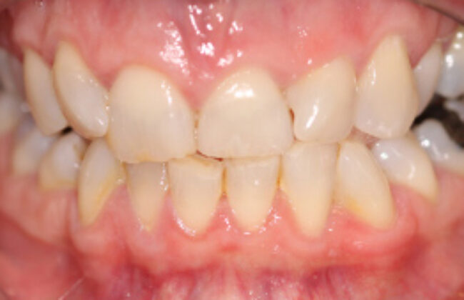 Before