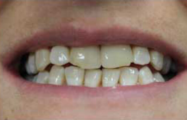 Before