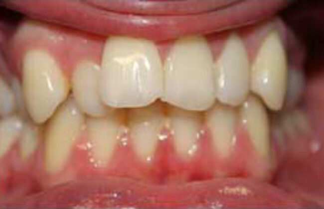 Before