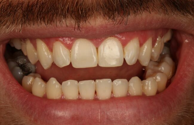 After