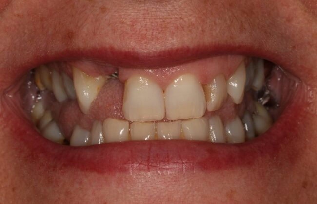Before
